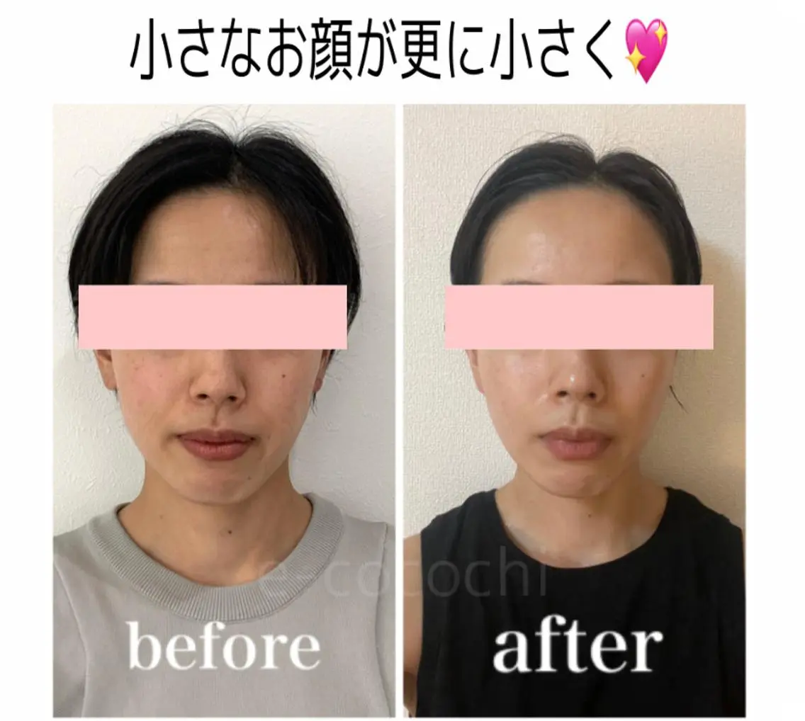エステ リラク 小顔と ヘッドスパのお店のエステ・リラクイメージ