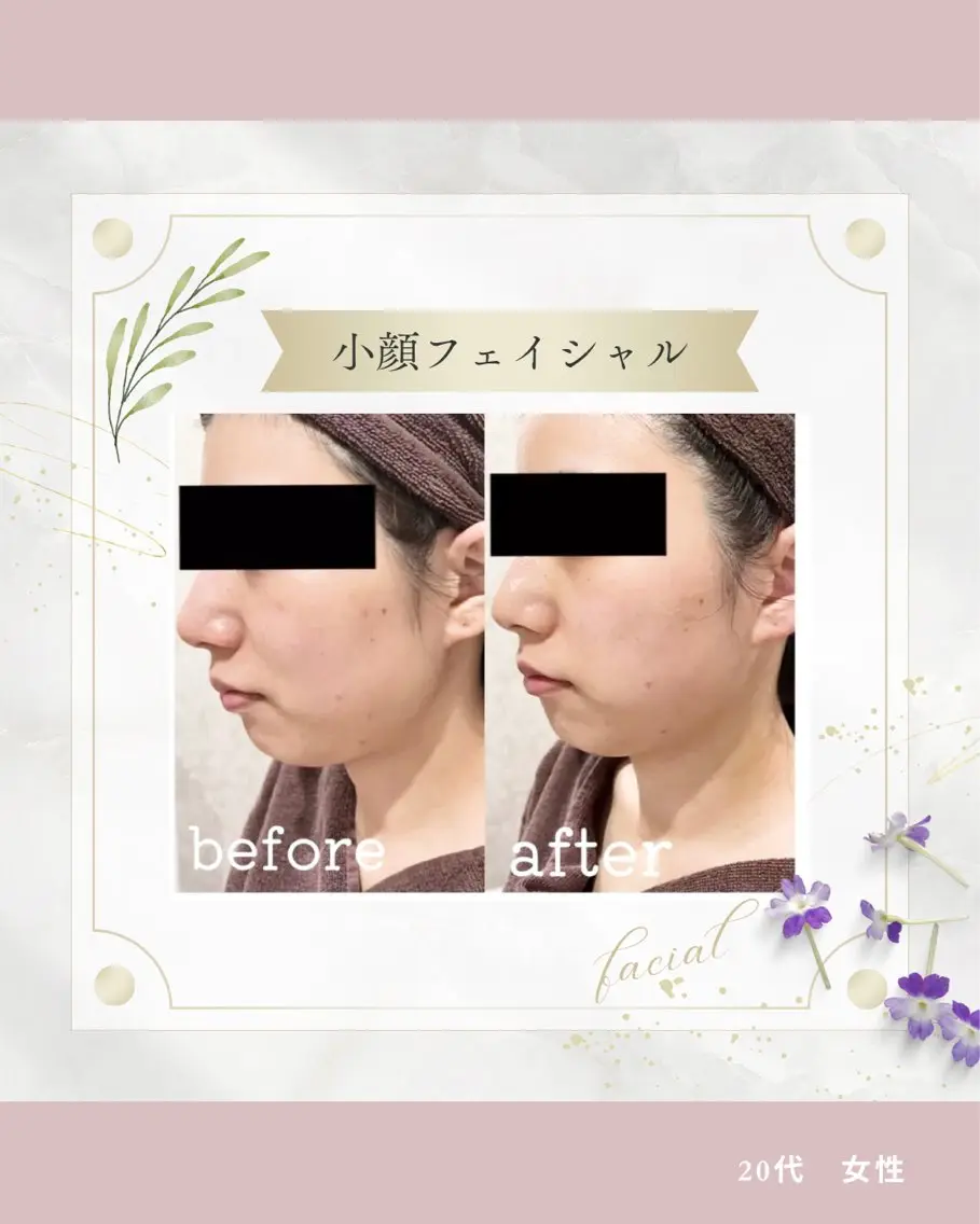 《 肌質×美肌 》 addissimoのエステ・リラクイメージ