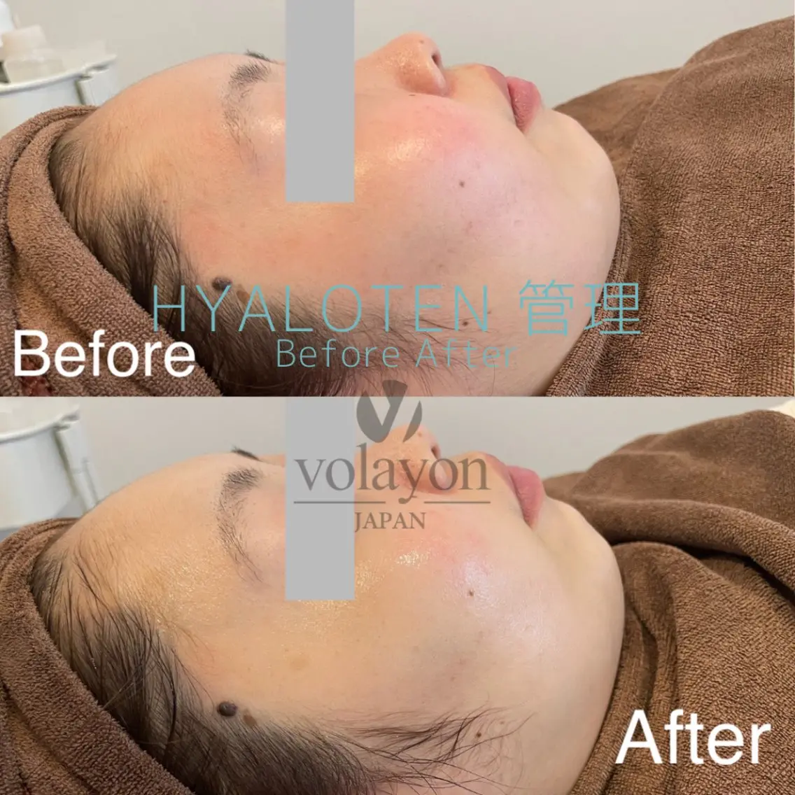 エステ リラク salon aretéのエステ・リラクイメージ