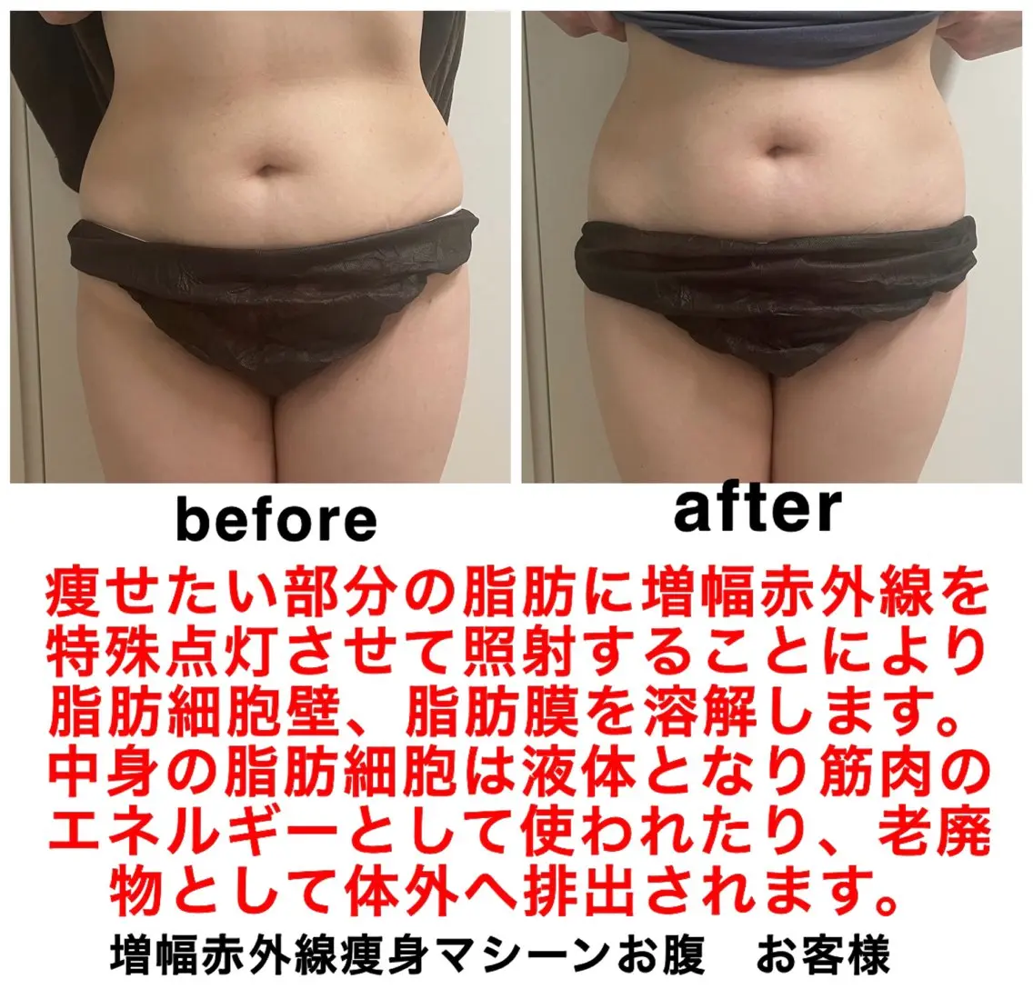 エステ ネイル・エステサロン UILANIのエステ・リラクイメージ