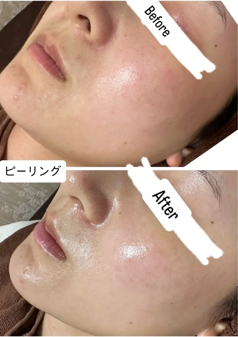 エステ 桐山 まどかのエステ・リラクイメージ