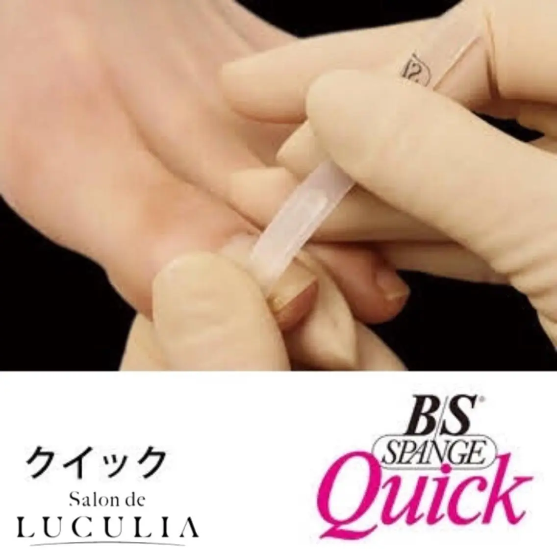 フット巻き爪矯正親指（BS）両足&マニキュア仕上げの写真