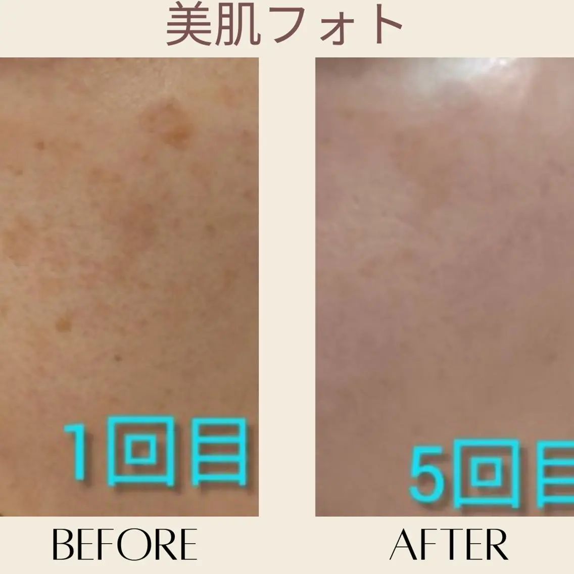 エステ MODE K's 白石彩夏のエステ・リラクイメージ