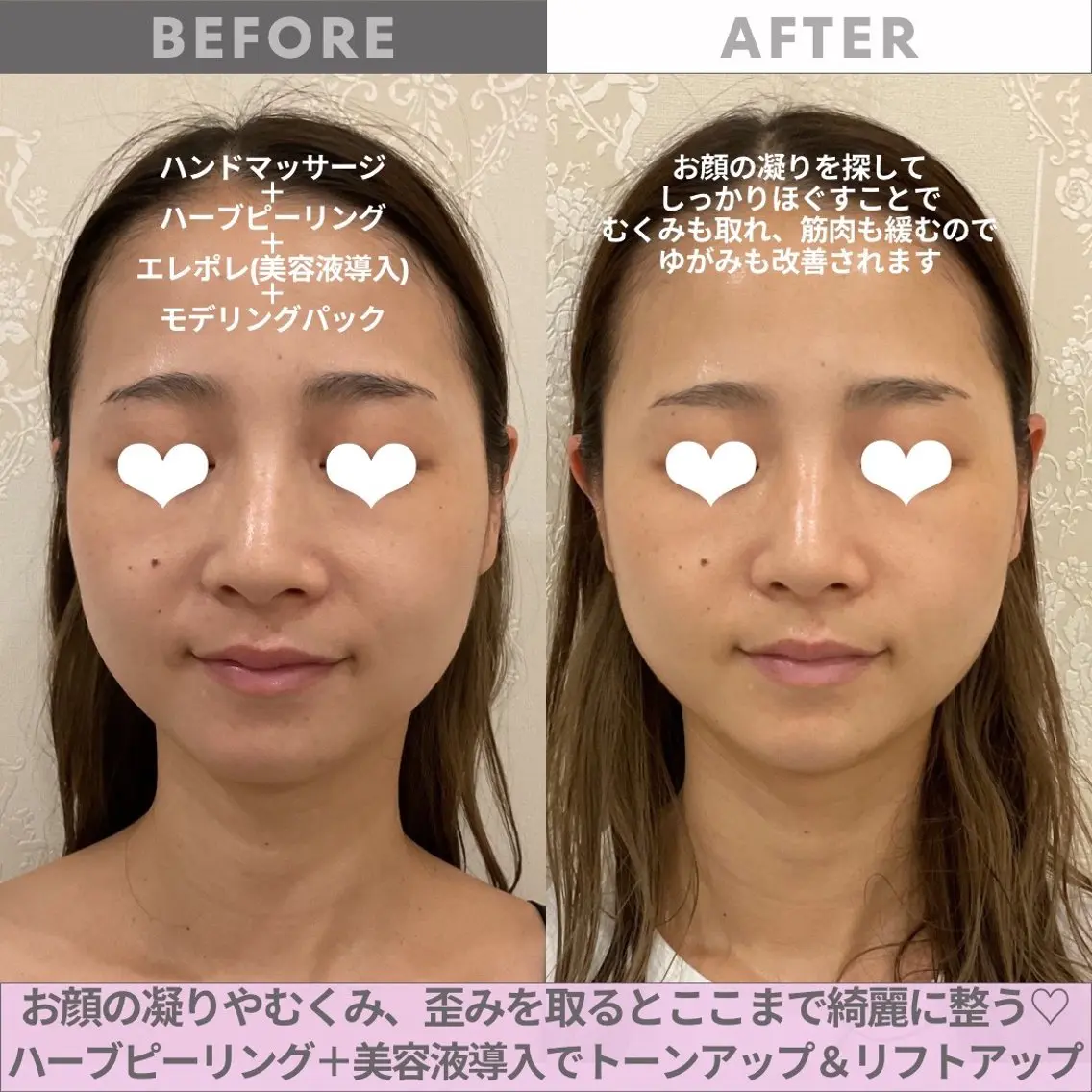 エステ リンデザ 山口のエステ・リラクイメージ