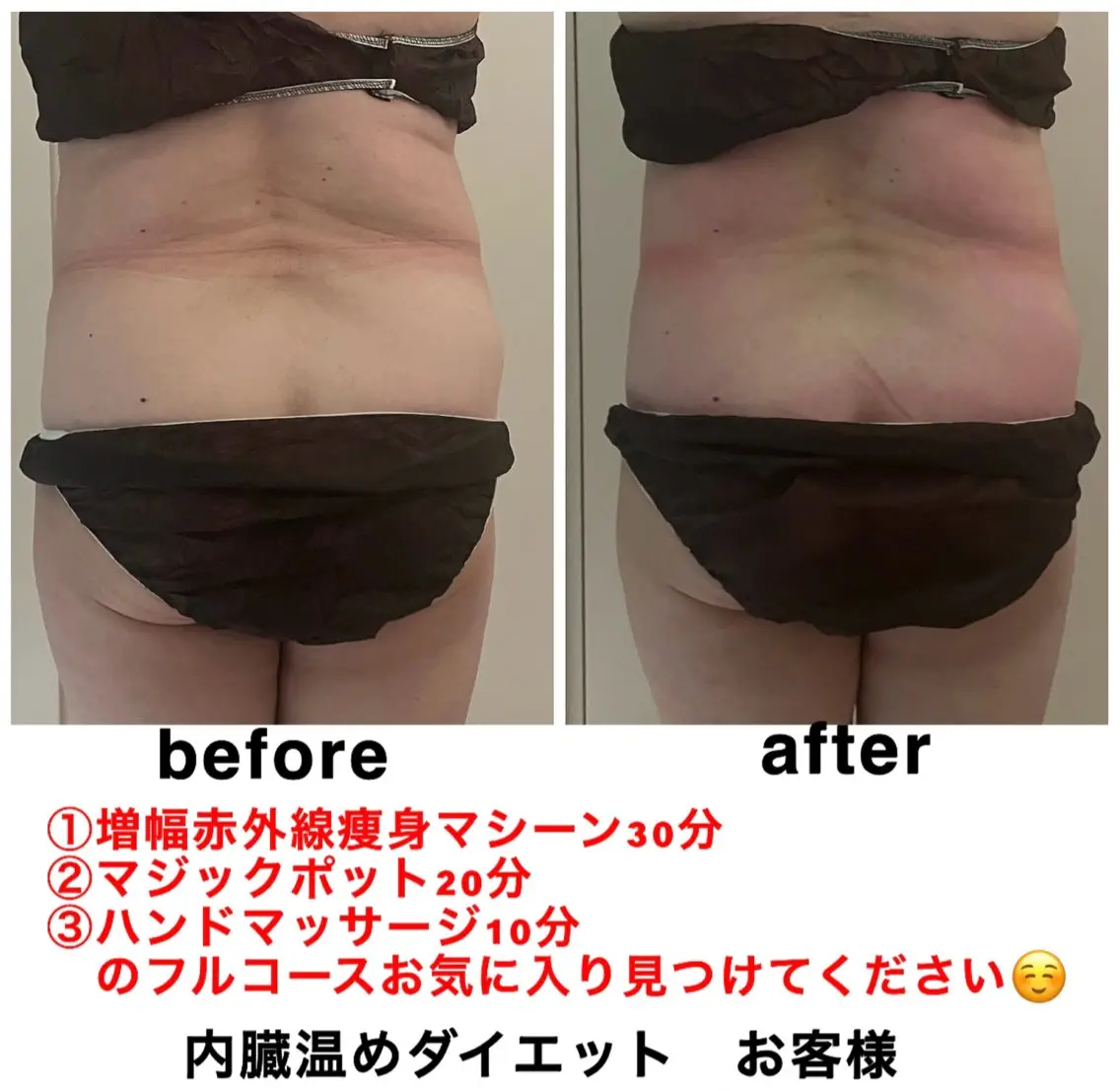 エステ ネイル・エステサロン UILANIのエステ・リラクイメージ