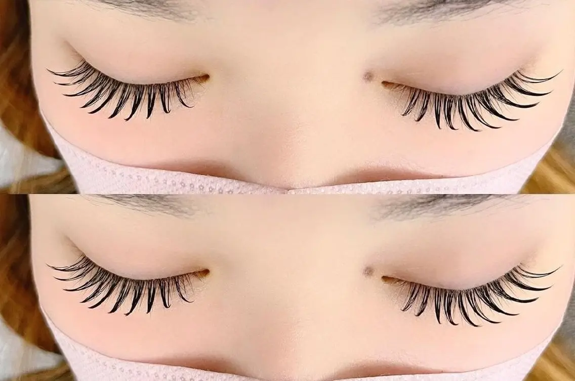 フラットラッシュ160本までの写真
