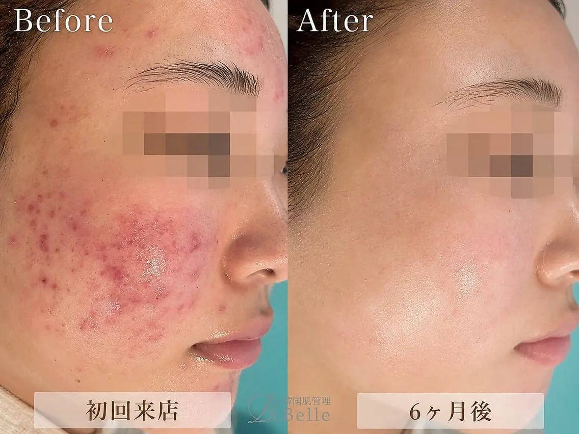 韓国肌管理Belle 静岡 前田のエステ・リラクイメージ