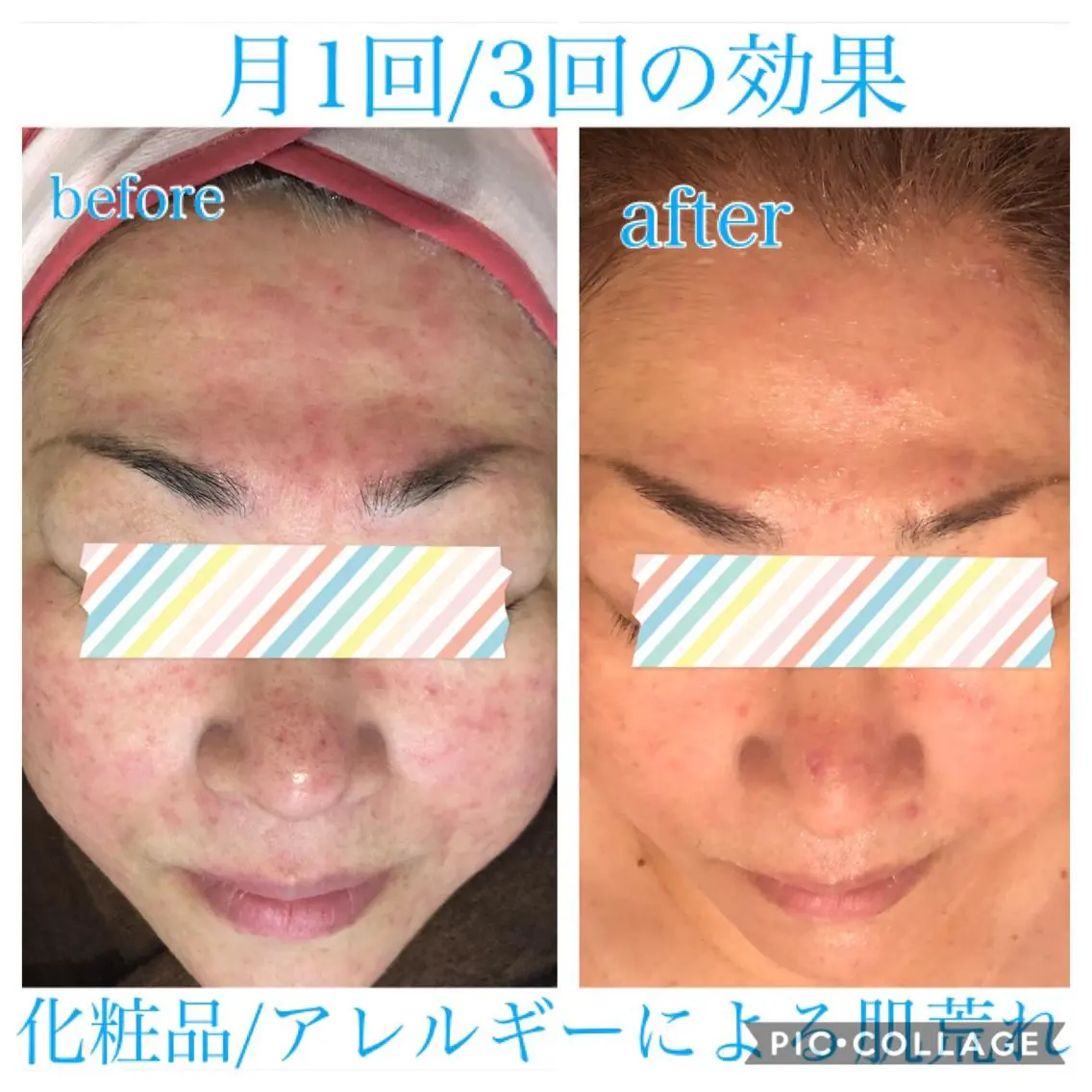ロング カラー パーマ ヘアアレンジ キッズ ネイル マツエク・マツパ エステ リラク EnsorClair 代表 野口真央のエステ・リラクイメージ