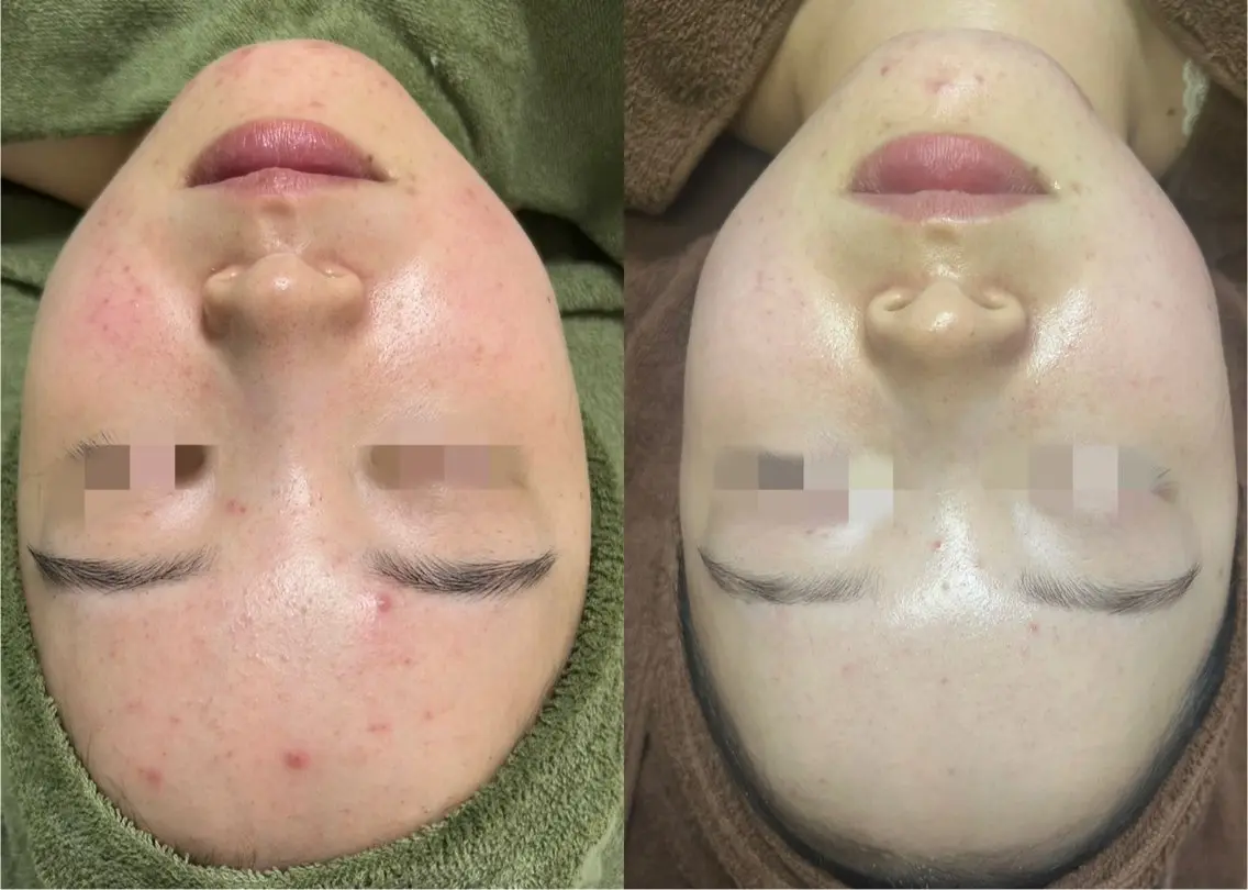 salon Leiのエステ・リラクイメージ