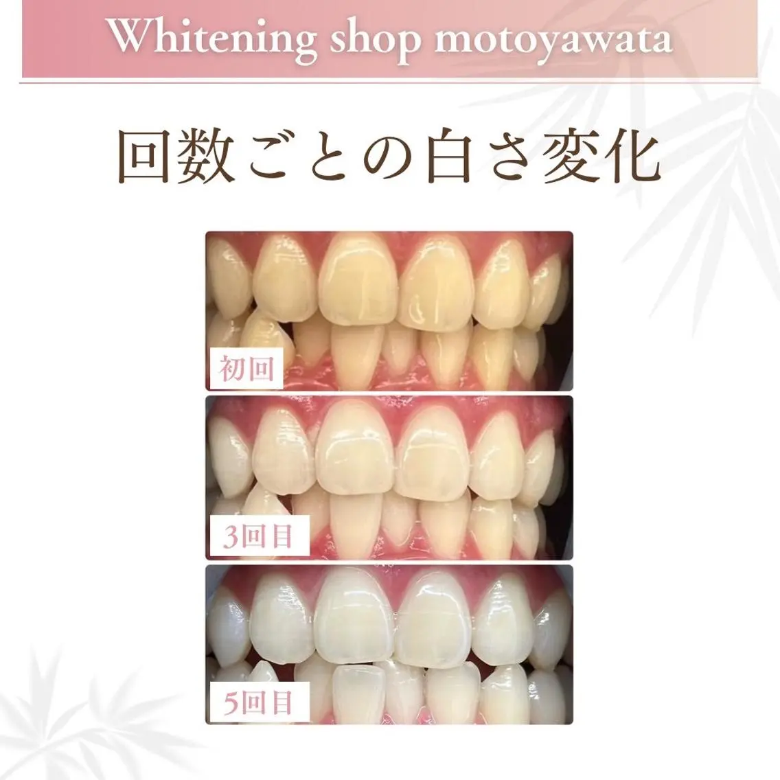 メンズ エステ リラク ホワイトニング ショップ本八幡店のエステ・リラクイメージ