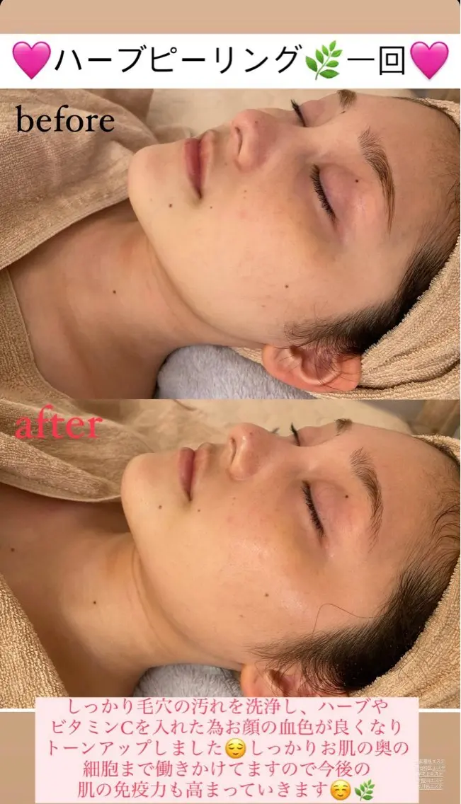 メンズ エステ Salon de Lino 御器所のエステ・リラクイメージ