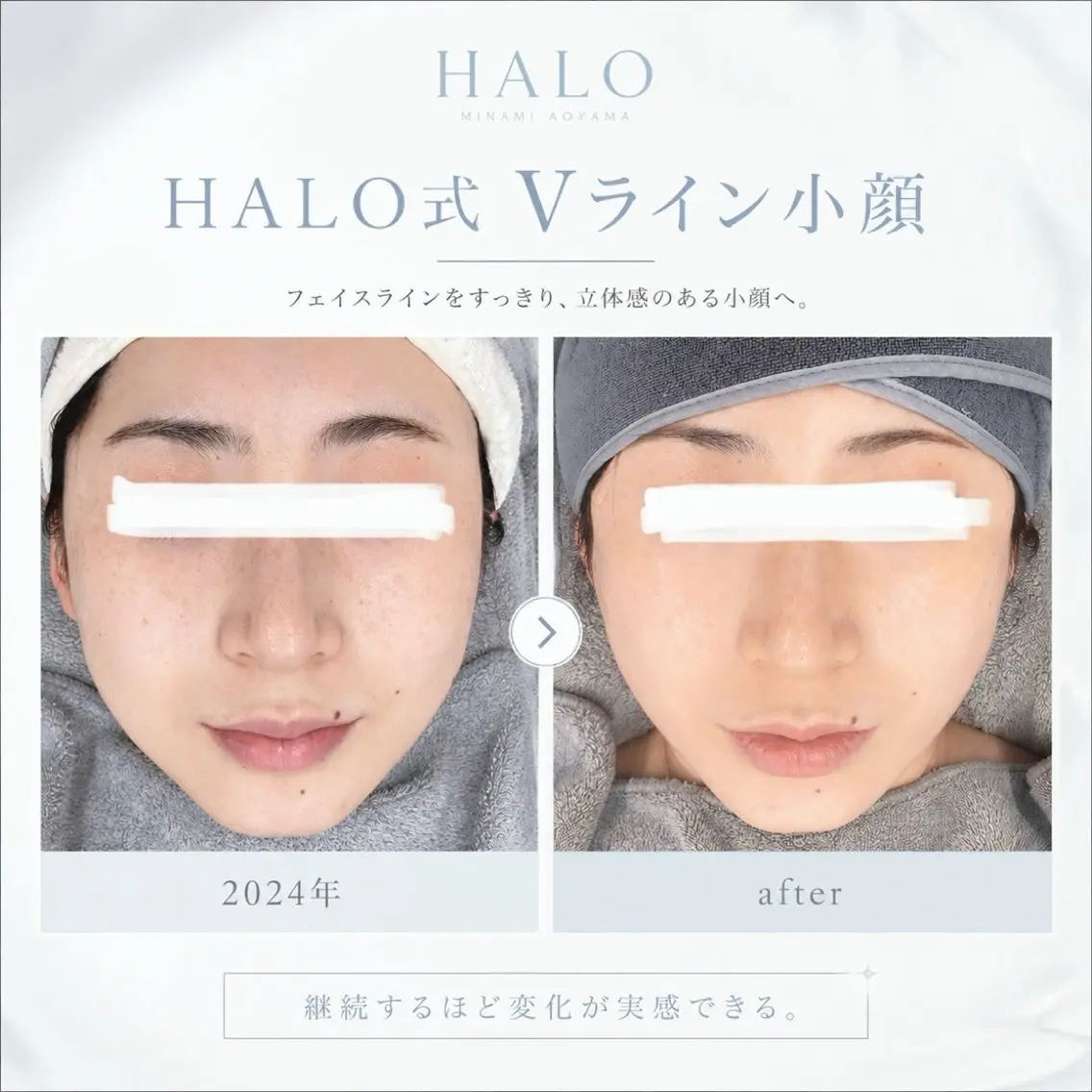 エステ 小顔痩身HALO 二宮早織のエステ・リラクイメージ