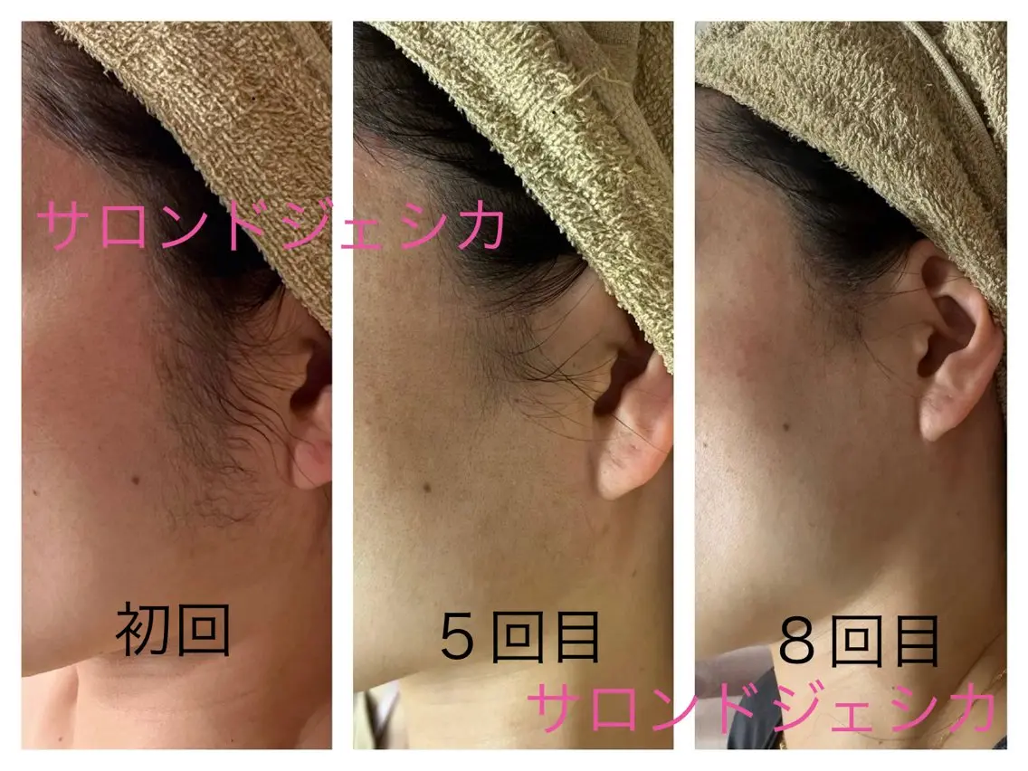 脱毛 salon de jessicaのエステ・リラクイメージ