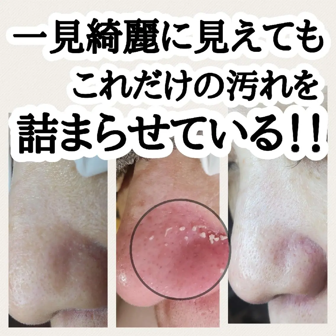 毛穴専門店 マカナアロハのエステ・リラクイメージ