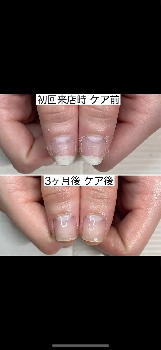 自爪育成|初回お試しコース|プレゼント付きの写真