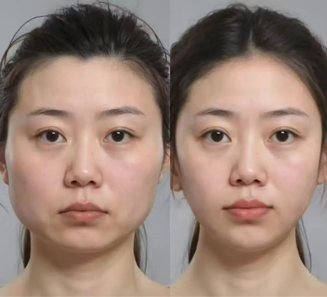 アイブロウ エステ 愛維美水光専門店 川崎彩鳳のエステ・リラクイメージ