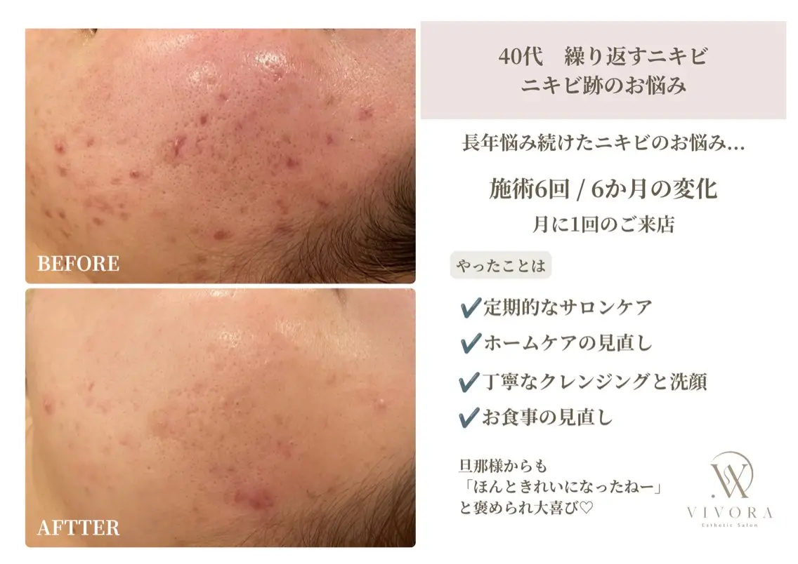 エステ VIVORA ASAMI🌿のエステ・リラクイメージ