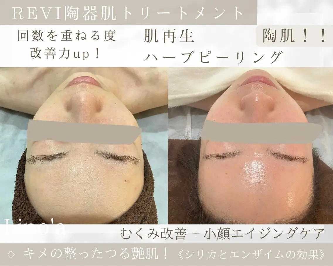 エステ リラク Salon💫 Lino'a柏店のエステ・リラクイメージ
