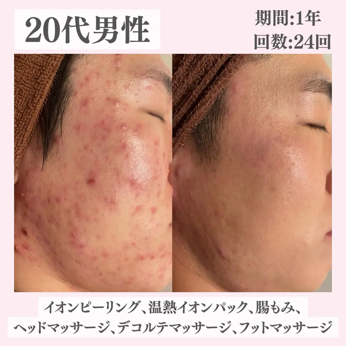 エステ リラク ニキビ・肌質改善専門 ♡人生が変わるサロンのエステ・リラクイメージ