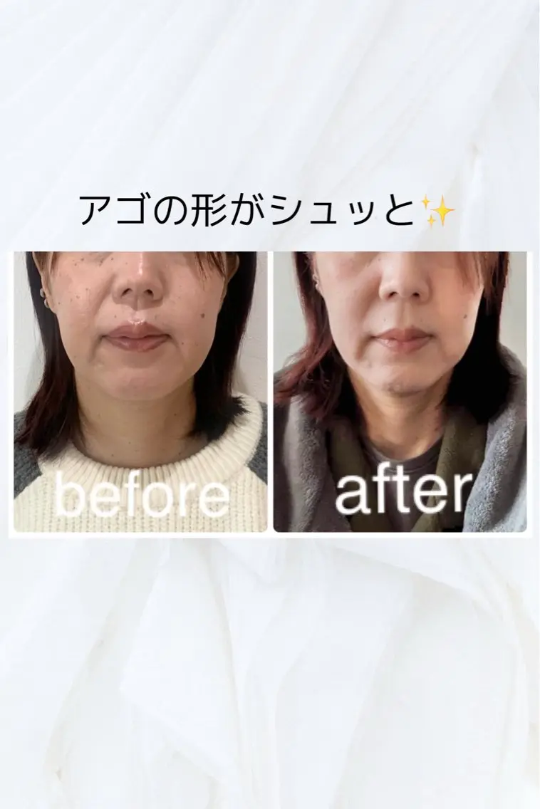 エステ リラク 小顔と ヘッドスパのお店のエステ・リラクイメージ