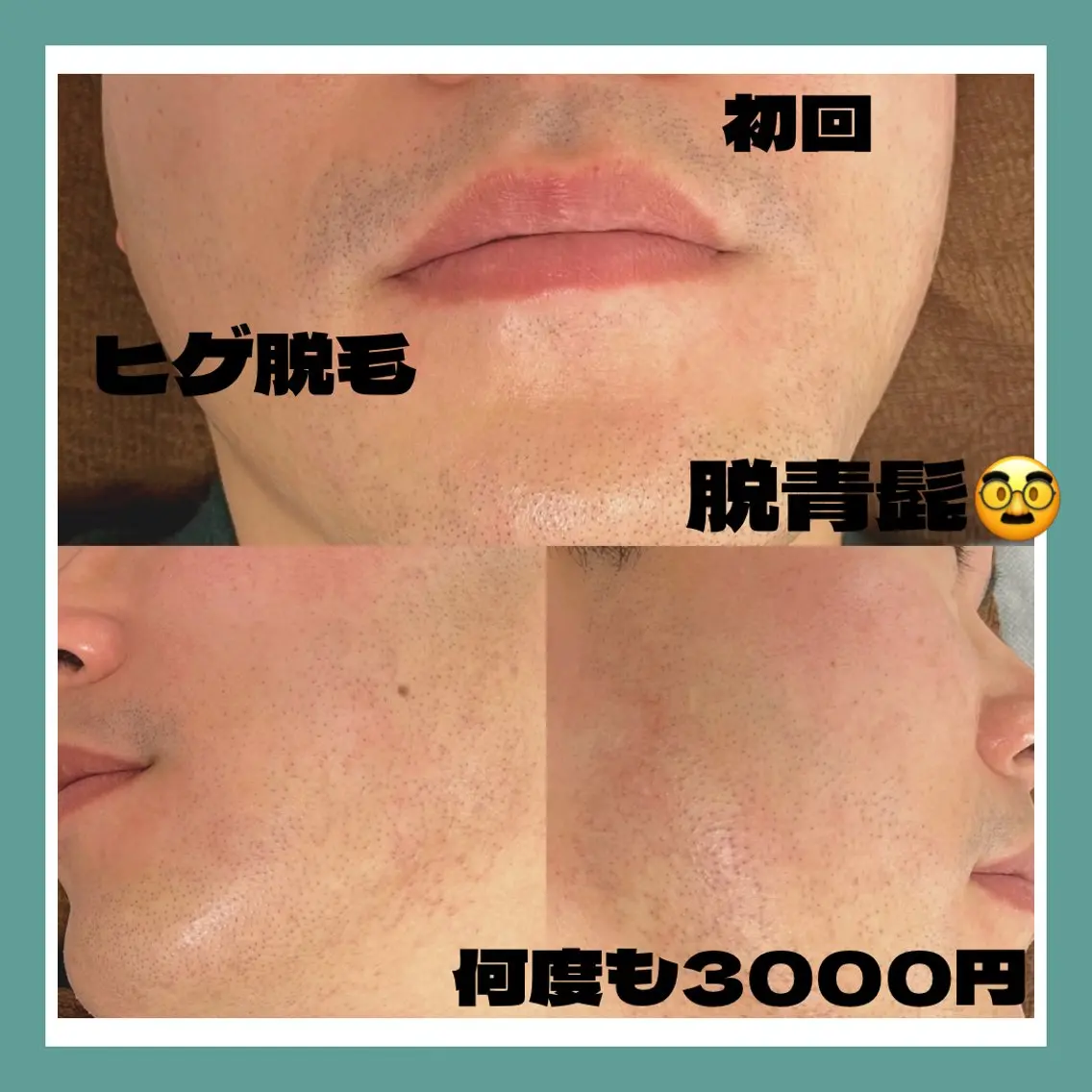 メンズ 脱毛 kaise makiのエステ・リラクイメージ