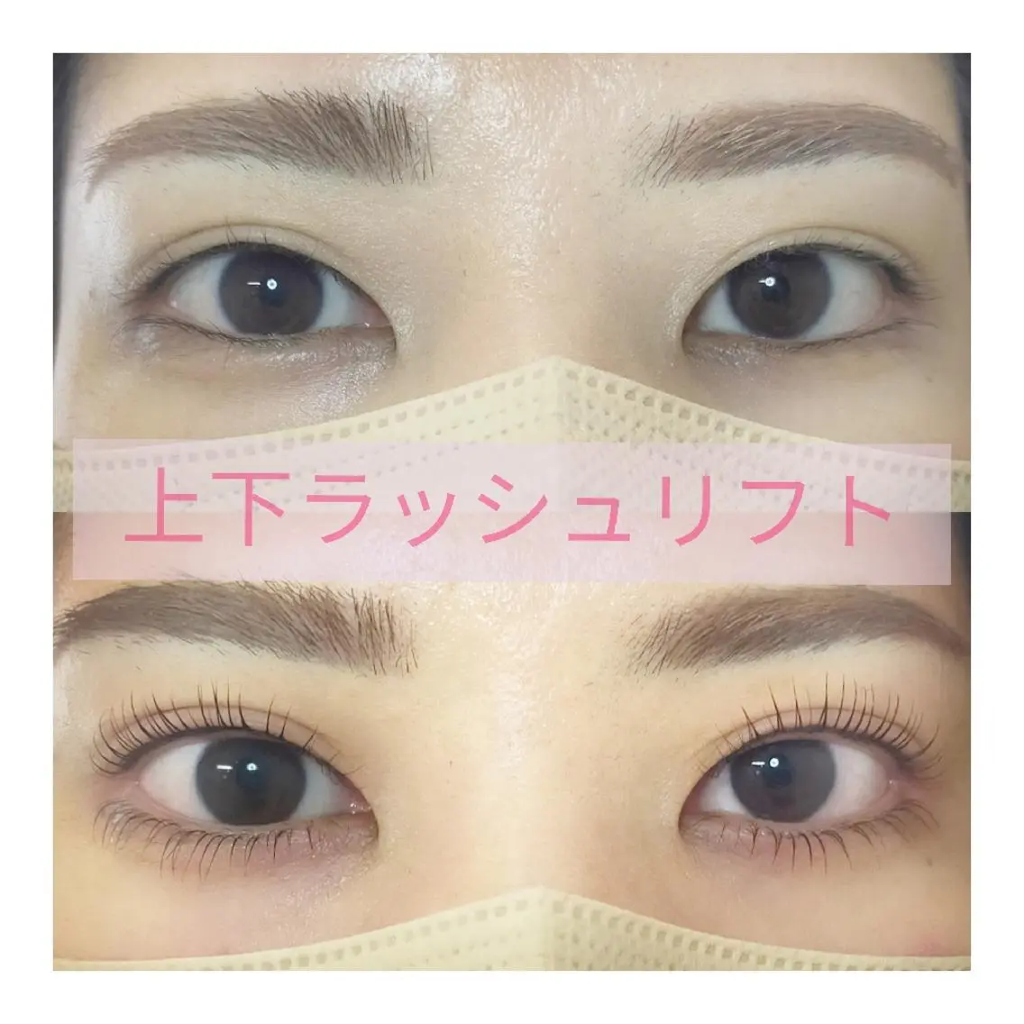 ラッシュリフト上下の写真