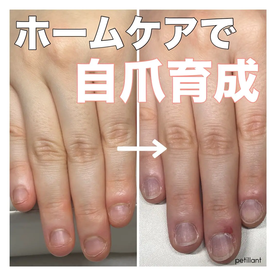 ネイル アートネイル nail salon petillantのネイルデザイン