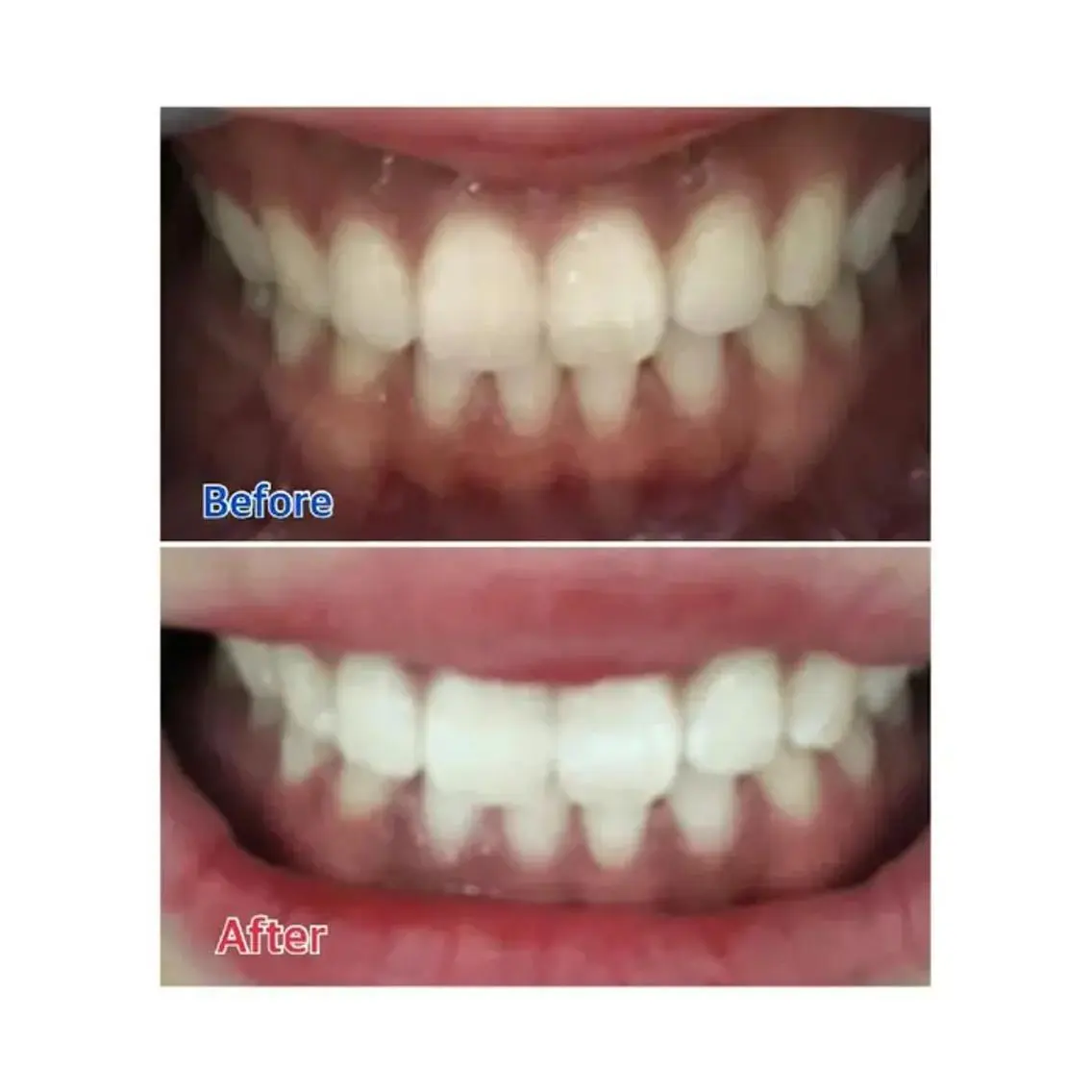 M渋谷 セルフホワイトニングのエステ・リラクイメージ