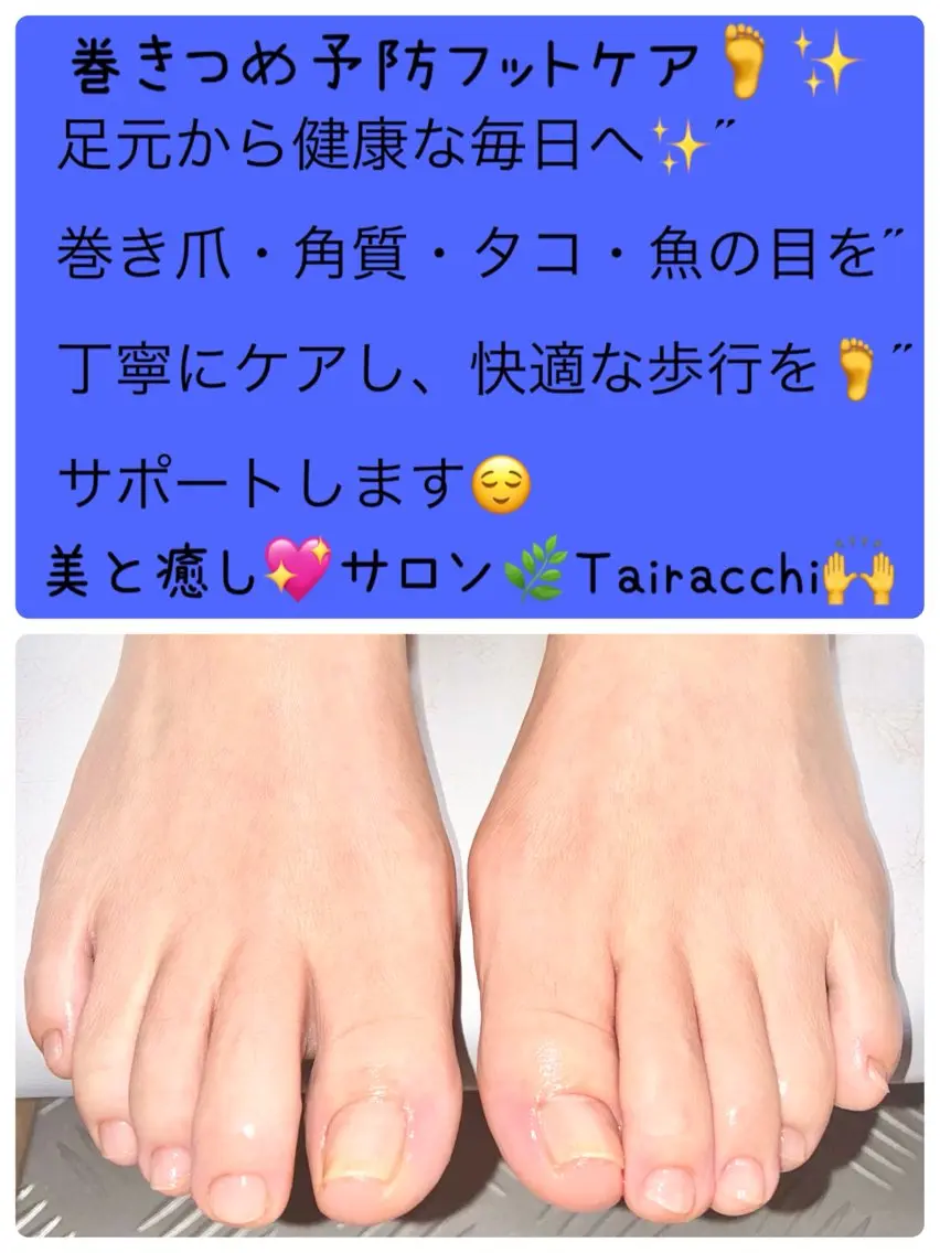 ネイル フットネイル Tairacchi タイラッチのエステ・リラクイメージ
