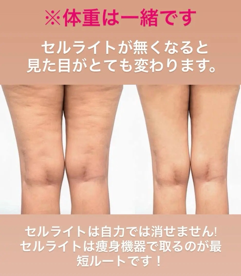 骨盤矯正ダイエット 結果出し＊痩身マシンのエステ・リラクイメージ