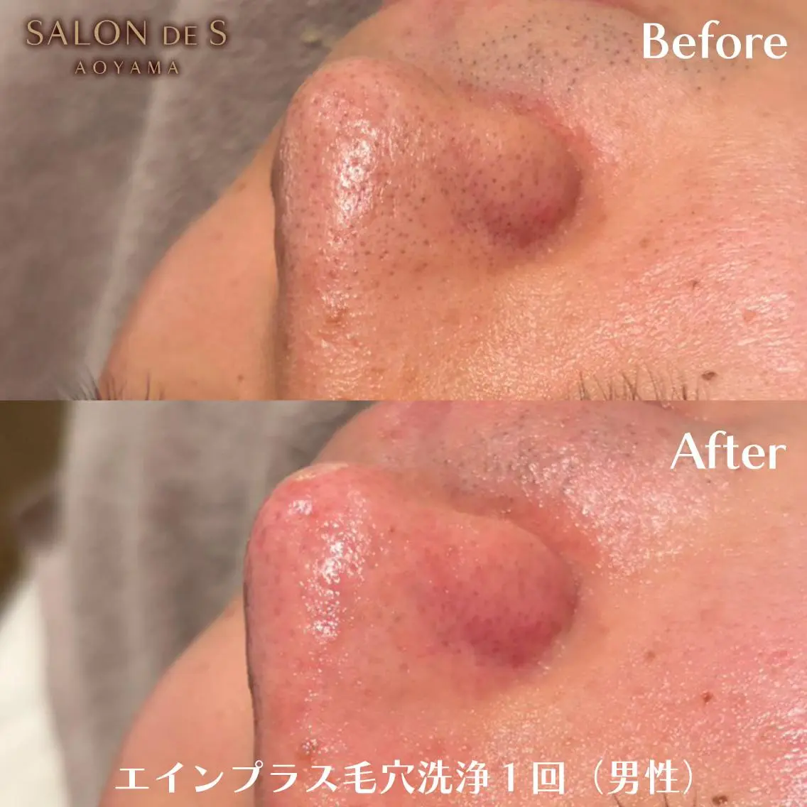 エステ SALON DE S 外苑前♡さやかのエステ・リラクイメージ