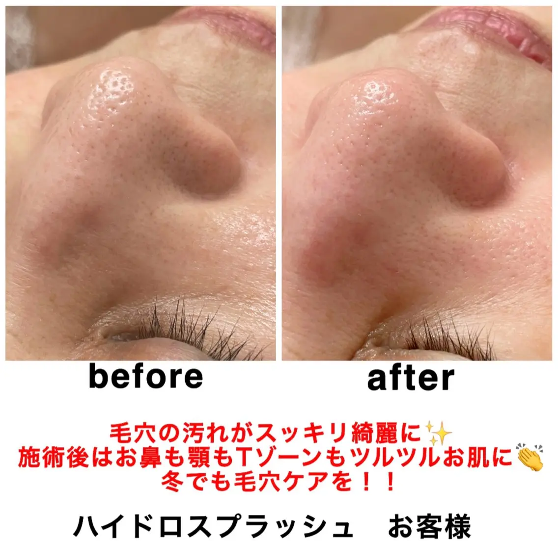 エステ リラク ネイル・エステサロン UILANIのエステ・リラクイメージ