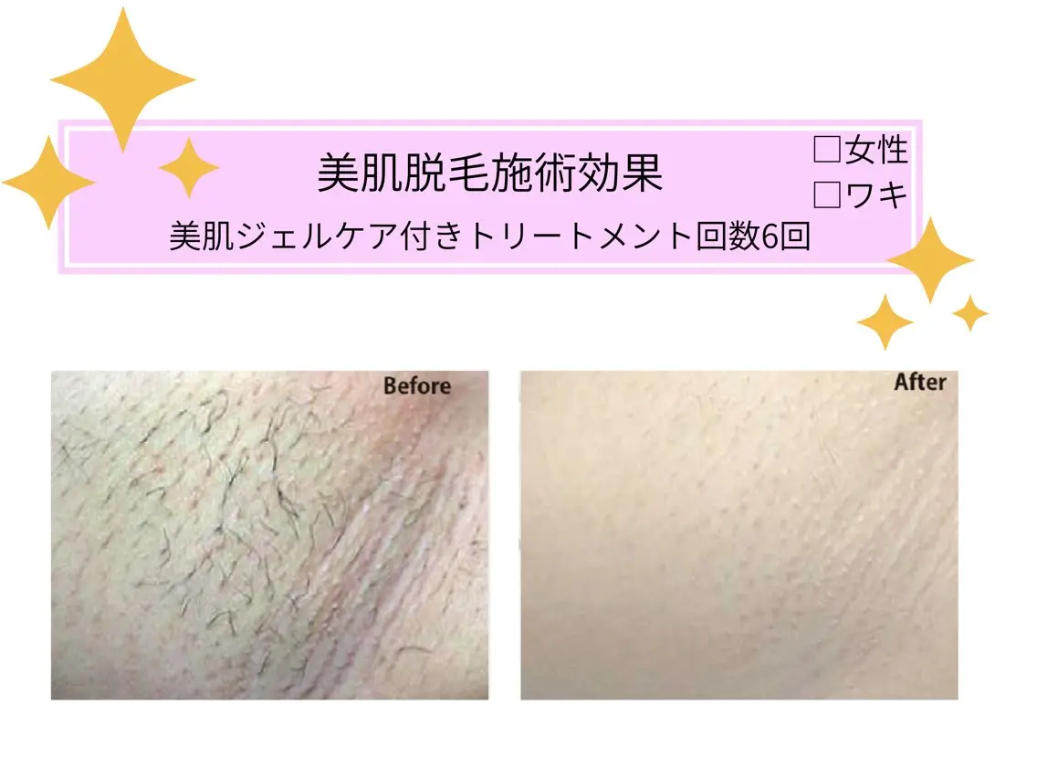 VIKI BEAUTYのエステ・リラクイメージ