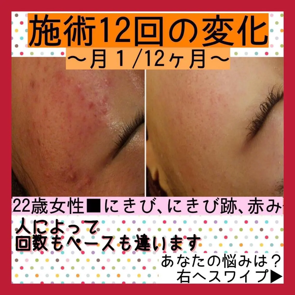 ミディアム カラー パーマ ヘアアレンジ メンズ キッズ ネイル マツエク・マツパ ニキビ・肌質改善専門 ♡人生が変わるサロンのエステ・リラクイメージ