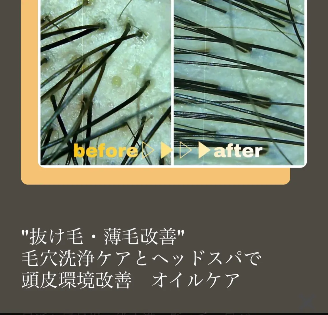 【抜け毛や細毛が気になる男性必見】カット+抜け毛・薄毛スキャルプケアコース ヘッドスパ+シェービング+フェイシャル付きの写真