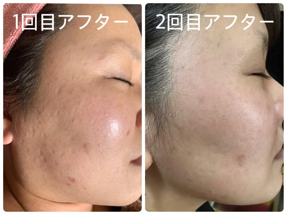 エステ デトックス専門サロン ココシュエットのエステ・リラクイメージ