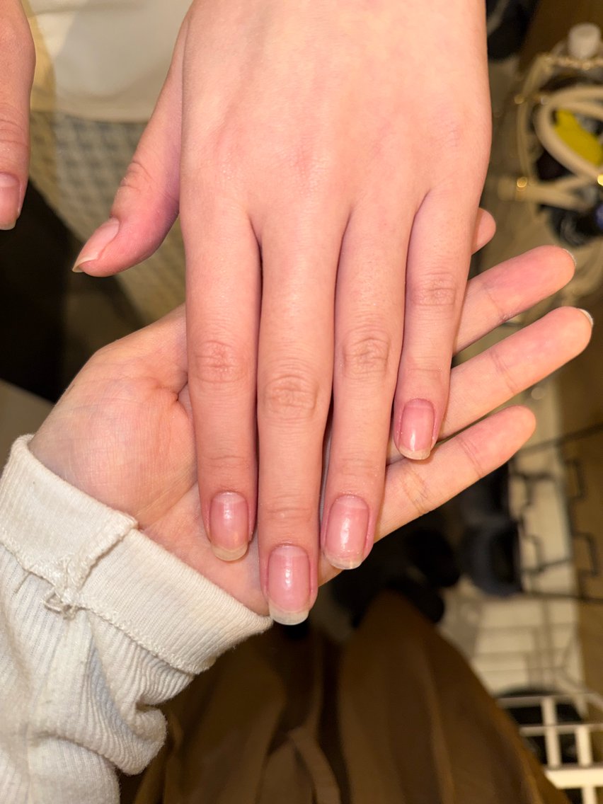 ソフトジェルオフのみの写真