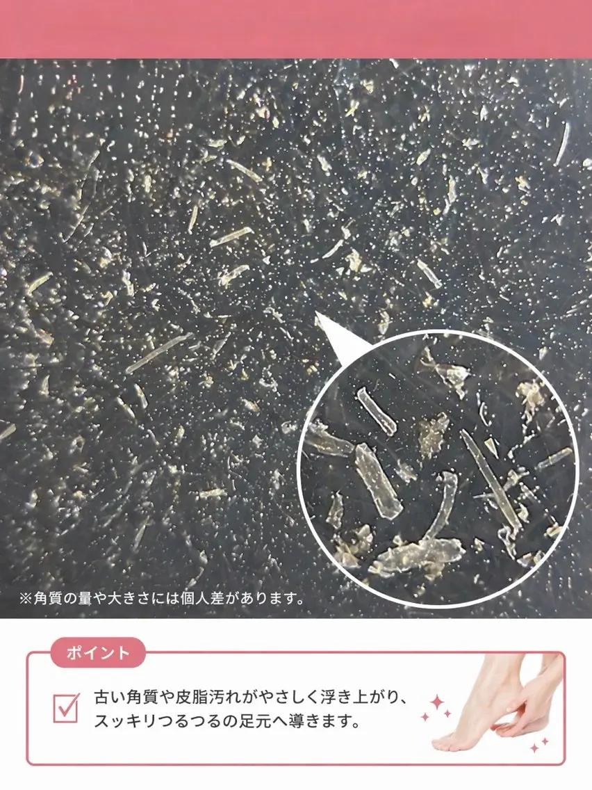足の角質ケア(フットバス付)の写真