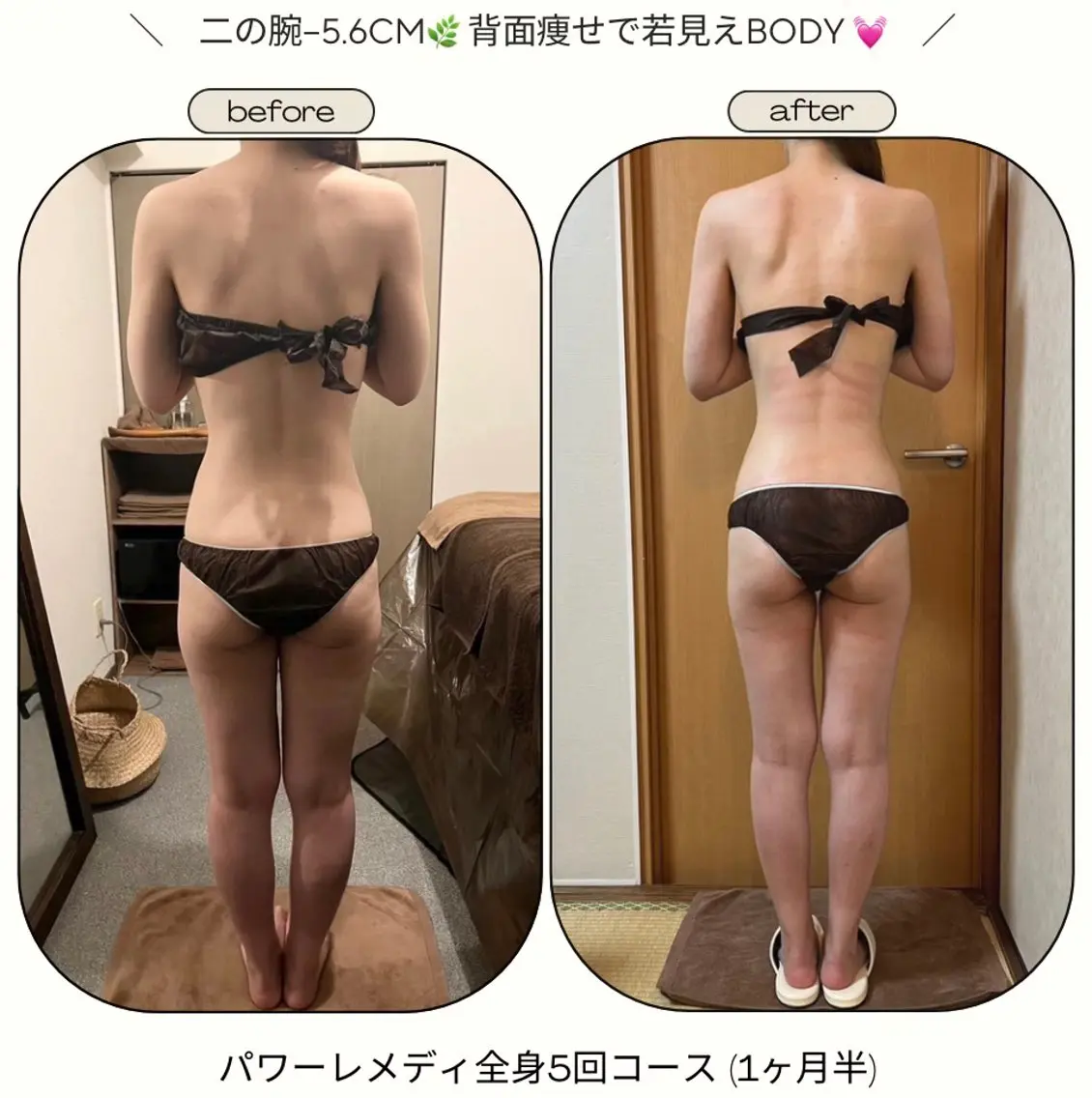 《本気痩せ×疲労改善 》  BILOOPのエステ・リラクイメージ
