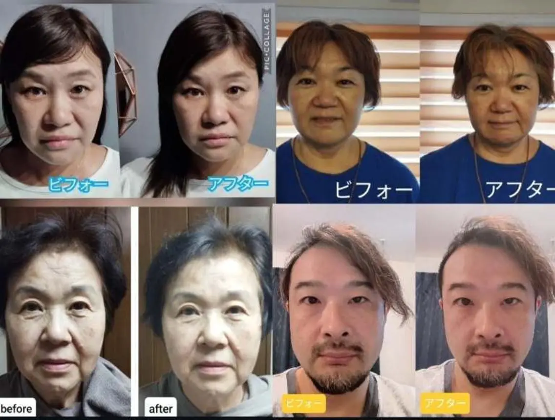 【✨綺麗になりたいあなたに✨】小顔矯正コース🙂(2回目まで有効)の写真