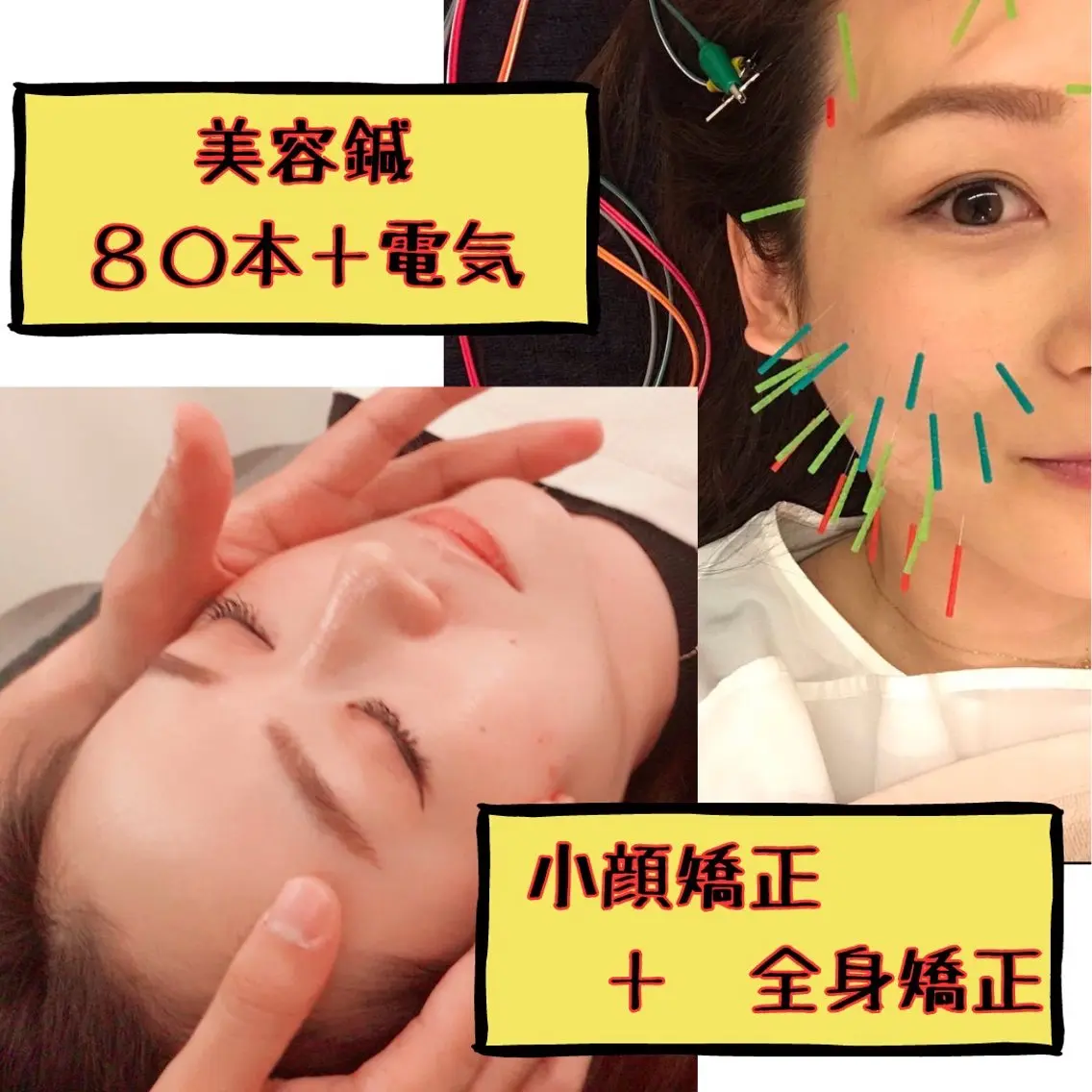 整体×美容鍼 ジェイペックのエステ・リラクイメージ