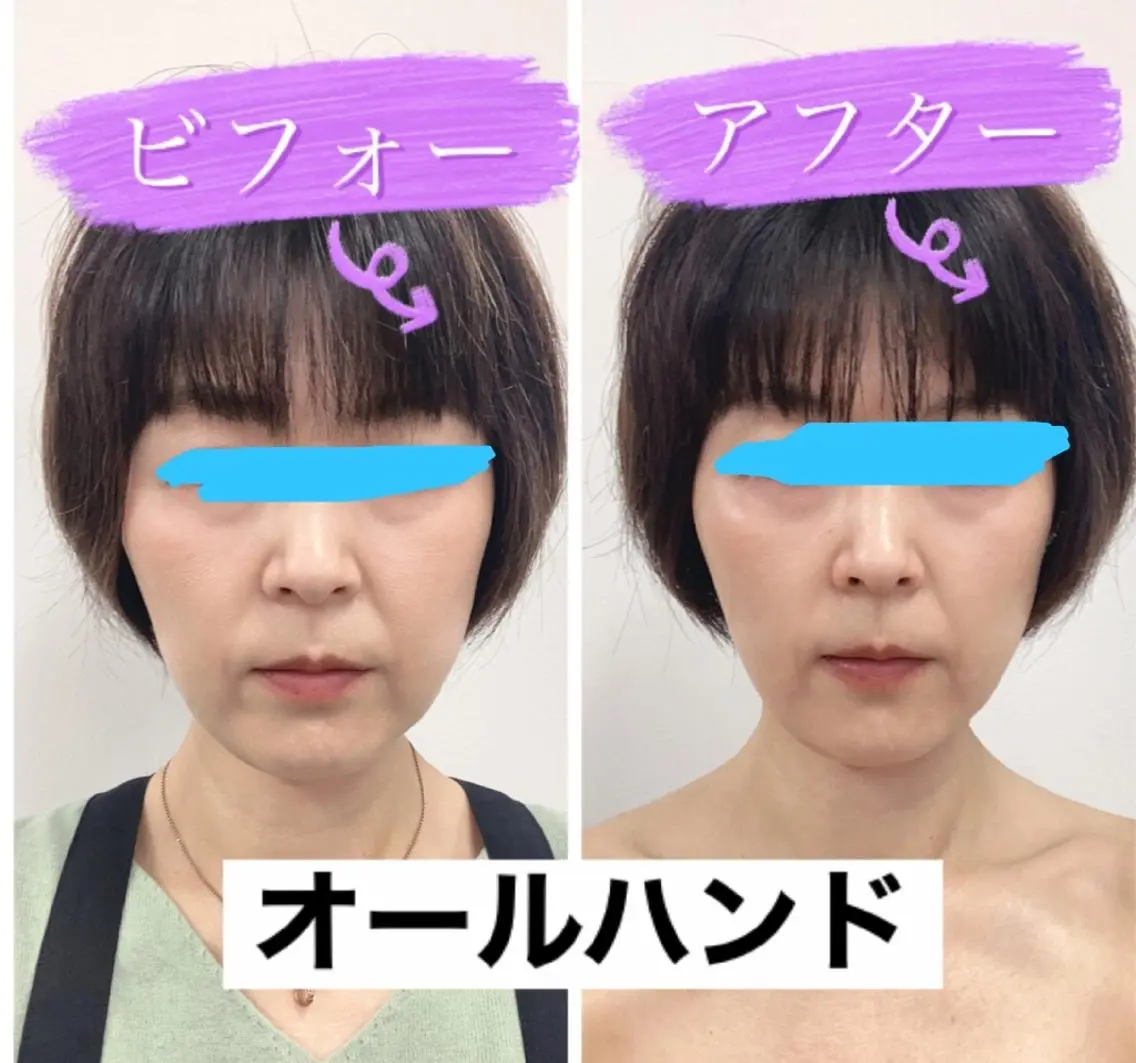 ショールームエステ becoのエステ・リラクイメージ