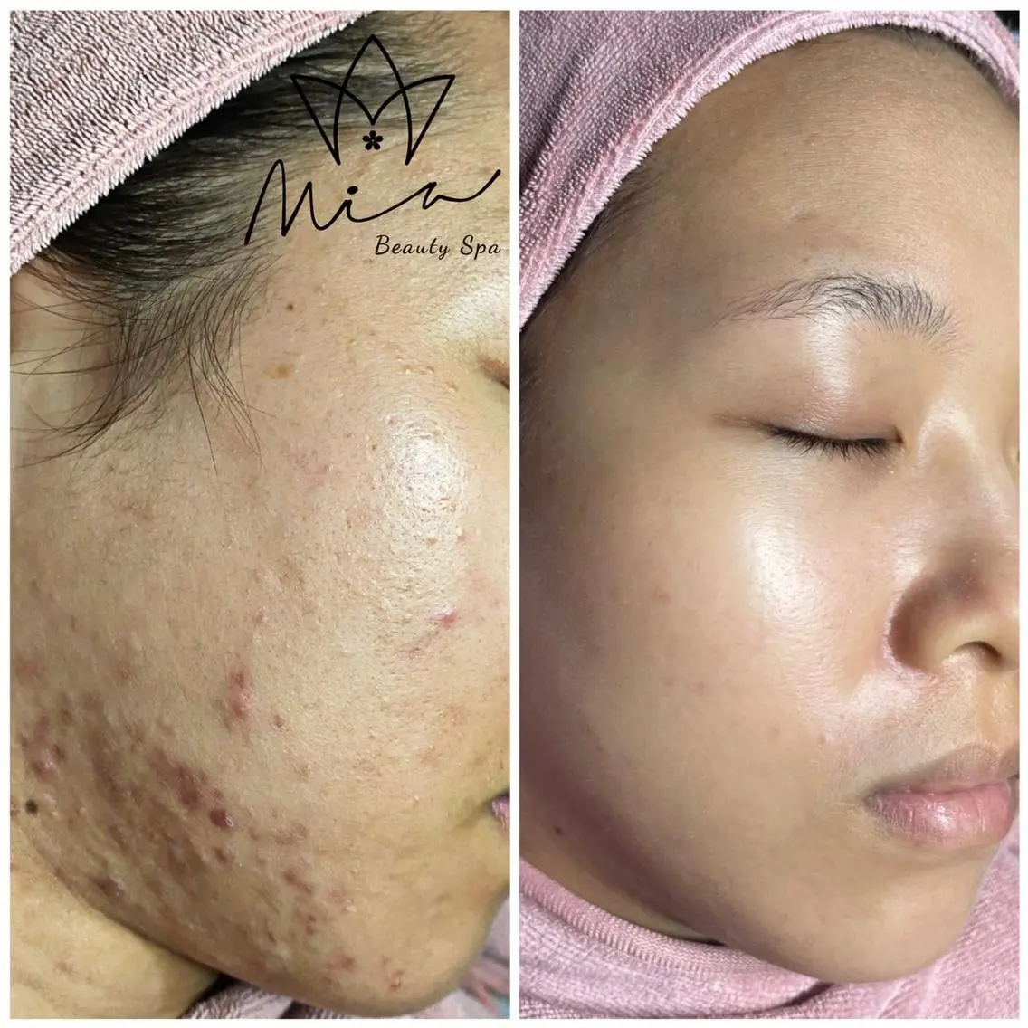 MiA Beautyのエステ・リラクイメージ