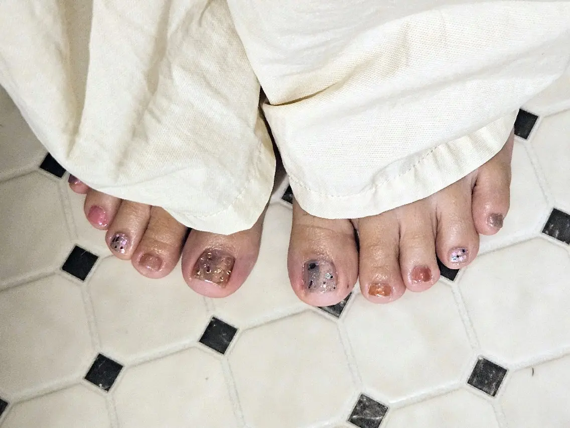 フットネイル　10本アートの写真