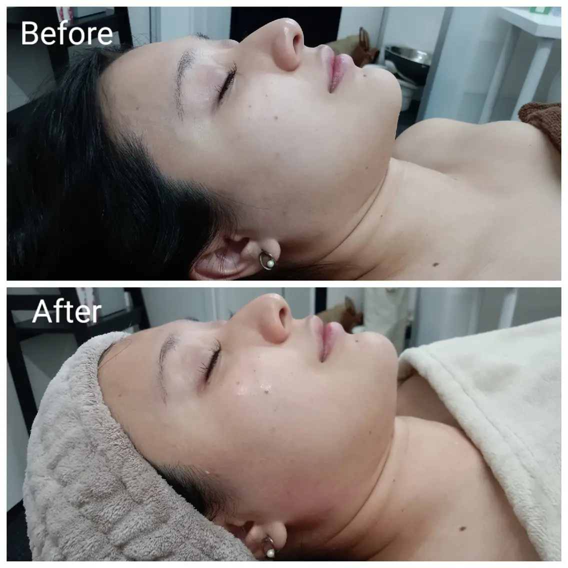 肌質改善Beauty salon Renのエステ・リラクイメージ