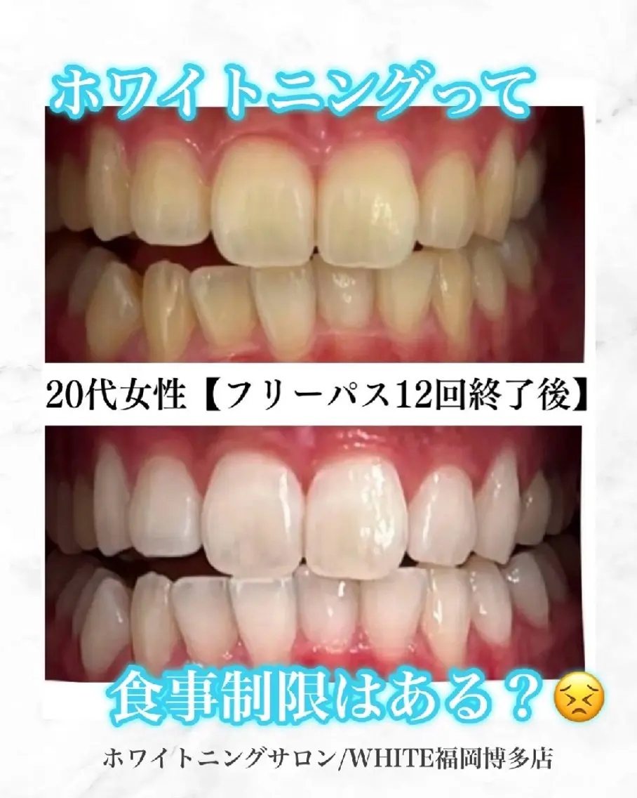キッズ メンズ エステ リラク セルフホワイトニング WHITE福岡博多店のエステ・リラクイメージ