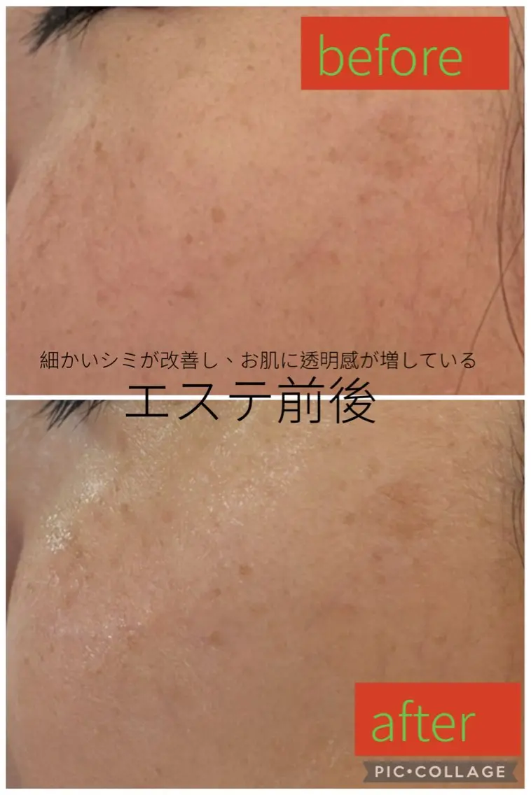 De I'm 堀のエステ・リラクイメージ