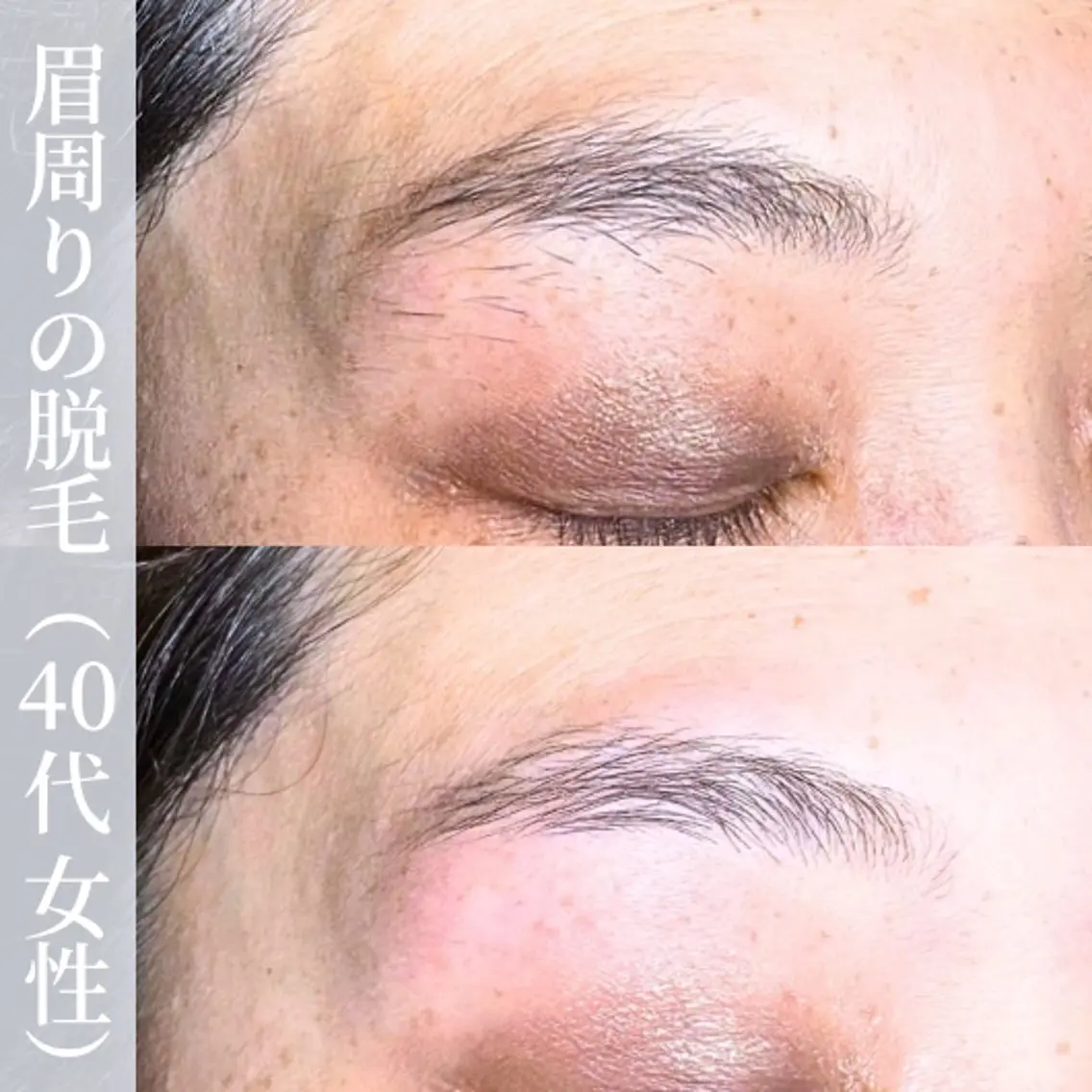 アイブロウ 眉毛ワックス脱毛 【一本ずつ脱毛】 ReMove 柏のエステ・リラクイメージ