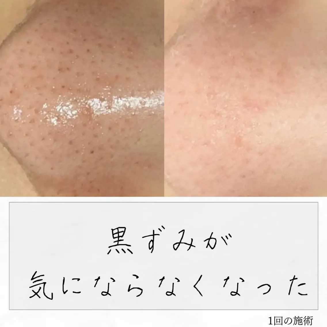 ニキビ経験者が施術 する専門サロン🌻のエステ・リラクイメージ