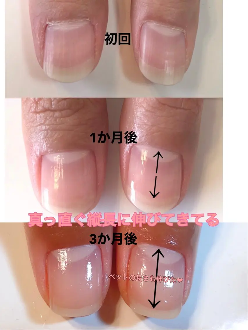 自爪育成ケア　自分史上最高の美爪にの写真